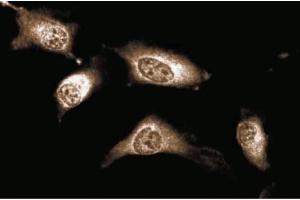 Immunofluorescent staining of Human Endothelial cells. (JAK1 抗体  (AA 551-766))