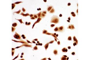 Anti-p63 antibody, ICC ICC: A549 Cell (p63 抗体  (C-Term))