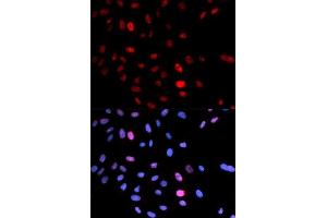 Immunofluorescence analysis of U2OS cells using Phospho-SMC1A-S957 antibody.