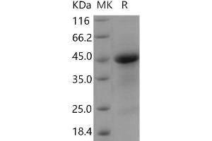 R-Spondin 1 (RSPO1) (Active) protein (His tag)