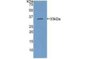 Detection of Recombinant MYH11, Rat using Polyclonal Antibody to Myosin Heavy Chain 11, Smooth Muscle (MYH11) (MYH11 抗体  (AA 211-482))