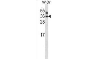 Western Blotting (WB) image for anti-Patatin-Like phospholipase Domain Containing 4 (PNPLA4) antibody (ABIN2997649) (PNPLA4 抗体)