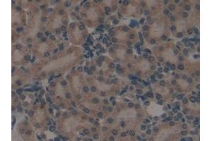 Detection of SP-B in Rat Kidney Tissue using Polyclonal Antibody to Surfactant Protein B (SP-B)