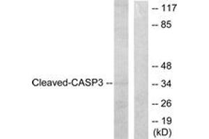 Western blot analysis of extracts from HeLa cells, treated with Etoposide 25uM 60', using Caspase 3 (Cleaved-Asp175) Antibody. (Caspase 3 抗体  (Cleaved-Asp175))