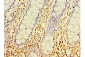 Immunohistochemistry of paraffin-embedded human colon tissue using ABIN7170540 at dilution of 1:100 (Spermidine Synthase 抗体  (AA 1-302))