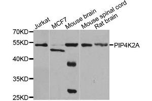 Western blot analysis of extracts of various cell lines, using PIP4K2A antibody. (PIP4K2A 抗体)