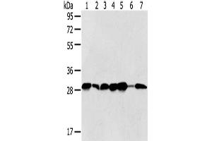 Gel: 8 % SDS-PAGE,Lysate: 40 μg,Lane 1-7: Jurkat cells, Hela cells, 293T cells, 231 cells, HepG2 cells, Human normal liver tissue, Human bladder carcinoma tissue,Primary antibody: ABIN7128021(SRPRB Antibody) at dilution 1/500 dilution,Secondary antibody: Goat anti rabbit IgG at 1/8000 dilution,Exposure time: 5 seconds (SRPRB 抗体)
