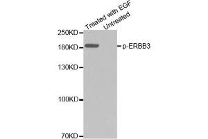 Western blot analysis of extracts from A431 cells using Phospho-ERBB3-Y1328 Antibody. (ERBB3 抗体  (pTyr1328))