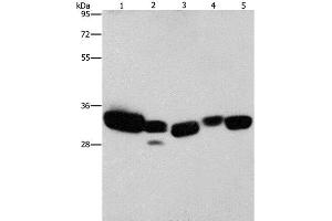 Western Blot analysis of Mouse liver and Human fetal lung tissue, hela cell and Mouse kidney tissue, Human brain malignant glioma tissue using CBR1 Polyclonal Antibody at dilution of 1:900 (CBR1 抗体)