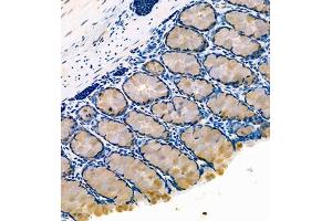 Immunohistochemistry of paraffin embedded rat colon using FCGBP (ABIN7073926) at dilution of 1:800 (250x lens) (FCGBP 抗体)