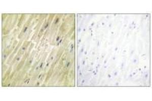 Immunohistochemistry analysis of paraffin-embedded human heart tissue using M-CK antibody. (CKM 抗体  (N-Term))