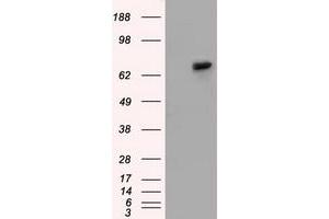 Western Blotting (WB) image for anti-Sorting Nexin 9 (SNX9) antibody (ABIN1501047) (SNX9 抗体)