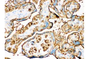 Immunohistochemistry (IHC) image for anti-Solute Carrier Family 2 (Facilitated Glucose Transporter), Member 1 (SLC2A1) (AA 92-492) antibody (ABIN3043927)