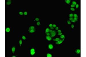 Immunofluorescent analysis of PC-3 cells using ABIN7151479 at dilution of 1:100 and Alexa Fluor 488-congugated AffiniPure Goat Anti-Rabbit IgG(H+L)
