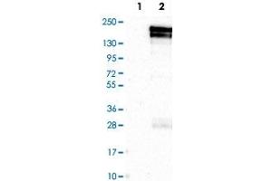 Western Blot analysis of Lane 1: negative control (vector only transfected HEK293T cell lysate) and Lane 2: over-expression lysate (co-expressed with a C-terminal myc-DDK tag in mammalian HEK293T cells) with KDM5B polyclonal antibody .