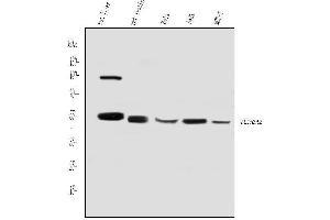 anti-Aldehyde Dehydrogenase 3 Family, Member A2 (ALDH3A2) (AA 1-100) antibody