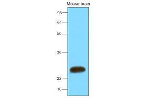 The extracts of mouse brain (30 ug) were resolved by SDS-PAGE, transferred to nitrocellulose membrane and probed with anti-human SNAP25 (1:2000). (SNAP25 抗体  (AA 1-206))