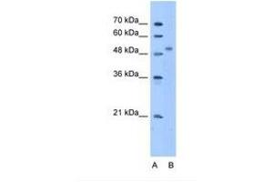 Image no. 1 for anti-Zinc Finger Protein 763 (ZNF763) (AA 51-100) antibody (ABIN341644) (ZNF763 抗体  (AA 51-100))