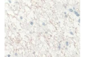 Immunohistochemistry (IHC) image for anti-Interleukin 10 (IL10) (AA 1-178) antibody (ABIN7425641)