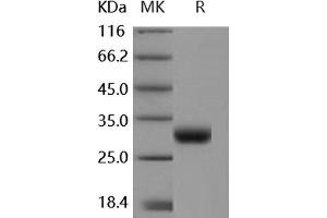 Western Blotting (WB) image for Coxsackie Virus and Adenovirus Receptor (CXADR) protein (ABIN7320433) (Coxsackie Adenovirus Receptor 蛋白)