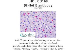 Image no. 3 for anti-CD163 (CD163) antibody (ABIN1721750) (CD163 抗体)