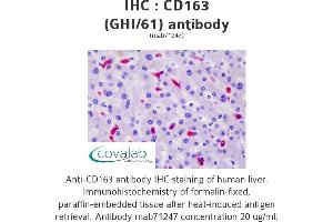 Image no. 3 for anti-CD163 (CD163) antibody (ABIN1721750) (CD163 抗体)