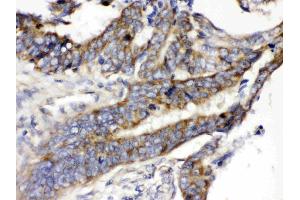 Immunohistochemistry (IHC) image for anti-Solute Carrier Family 2 (Facilitated Glucose/fructose Transporter), Member 5 (SLC2A5) (AA 223-259), (Middle Region) antibody (ABIN4886727)