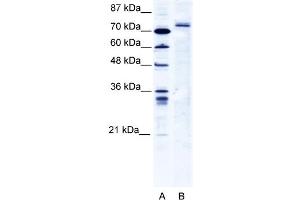 WB Suggested Anti-TRIM9 Antibody   Titration: 2. (TRIM9 抗体  (C-Term))