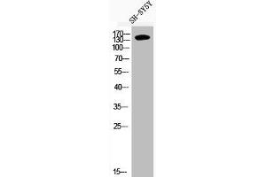 Western Blot analysis of SH-SY5Y cells using Phospho-IRS-1 (S636) Polyclonal Antibody