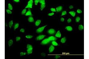Image no. 1 for anti-conserved Helix-Loop-Helix Ubiquitous Kinase (CHUK) (AA 646-745) antibody (ABIN598611) (IKK alpha 抗体  (AA 646-745))