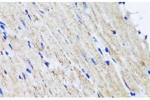Immunohistochemistry of paraffin-embedded Mouse heart using HYAL1 Polyclonal Antibody at dilution of 1:100 (40x lens). (HYAL1 抗体)