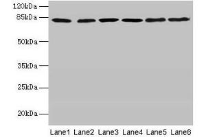 Western blot All lanes: CAPN1 antibody at 6 μg/mL Lane 1: A375 whole cell lysate Lane 2: 293T whole cell lysate Lane 3: PC-3 whole cell lysate Lane 4: Jurkat whole cell lysate Lane 5: Hela whole cell lysate Lane 6: A2780 whole cell lysate Secondary Goat polyclonal to rabbit IgG at 1/10000 dilution Predicted band size: 82 kDa Observed band size: 82 kDa (CAPNL1 抗体  (Catalytic Subunit))