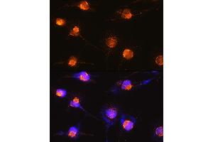 Immunofluorescence (IF) image for anti-S100 Calcium Binding Protein B (S100B) (AA 1-92) antibody (ABIN3021048)