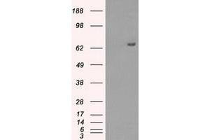 Western Blotting (WB) image for anti-Histone Deacetylase 10 (HDAC10) antibody (ABIN1498615) (HDAC10 抗体)