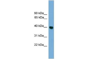 WB Suggested Anti-GNAI3 Antibody Titration: 0. (GNAI3 抗体  (Middle Region))
