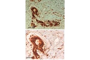 Immunohistochemistry (IHC) image for anti-ATP-Binding Cassette, Sub-Family B (MDR/TAP), Member 5 (ABCB5) (Internal Region) antibody (ABIN349592)