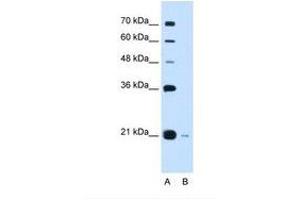 Image no. 2 for anti-DCTP Pyrophosphatase 1 (DCTPP1) (C-Term) antibody (ABIN6738241) (DCTPP1 抗体  (C-Term))