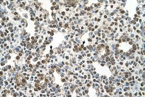 Image no. 1 for anti-Oxysterol Binding Protein-Like 9 (OSBPL9) (AA 73-122) antibody (ABIN6736683) (OSBPL9 抗体  (AA 73-122))