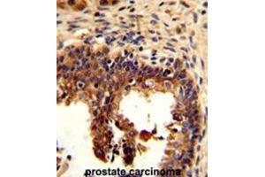 Immunohistochemistry (IHC) image for anti-Keratin 4 (KRT4) antibody (ABIN3002775) (KRT4 抗体)
