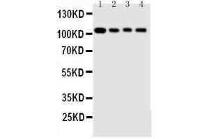 Anti-Hsp105 antibody, Western blotting Lane 1: Rat Ovary Tissue Lysate Lane 2: A549 Cell Lysate Lane 3: U87 Cell Lysate Lane 4: HELA Cell Lysate (HSPH1 抗体  (C-Term))