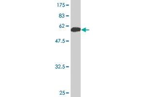 Western Blot detection against Immunogen (53. (14-3-3 sigma/SFN 抗体  (AA 1-248))