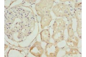 Immunohistochemistry of paraffin-embedded human kidney tissue using ABIN7169101 at dilution of 1:100 (NEK3 抗体  (AA 267-506))