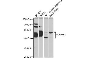 Western blot analysis of extracts of various cell lines, using ADAP1 antibody. (ADAP1 抗体)