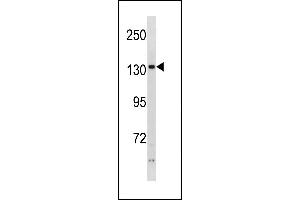 PHKA2 Antibody (N-term) (ABIN1881651 and ABIN2843259) western blot analysis in ZR-75-1 cell line lysates (35 μg/lane). (PHKA2 抗体  (N-Term))