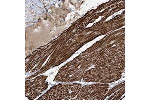 Immunohistochemical staining of human smooth muscle with RASGEF1A polyclonal antibody  shows strong cytoplasmic positivity in smooth muscle cells at 1:200-1:500 dilution.