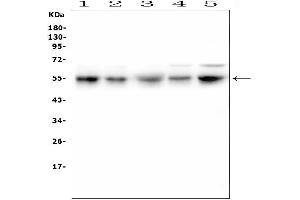 Western blot analysis of RBMS3 using anti-RBMS3 antibody (ABIN6719584).