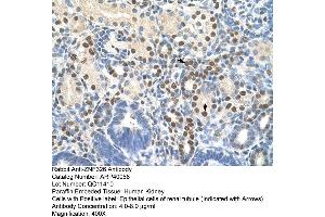 Human kidney (ZNF326 抗体  (C-Term))
