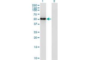 Western Blot analysis of FLI1 expression in transfected 293T cell line by FLI1 monoclonal antibody (M02), clone 2G8. (FLI1 抗体  (AA 1-452))