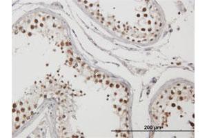 Immunohistochemistry (Formalin-fixed Paraffin-embedded Sections) (IHC (fp)) image for anti-TRM1 tRNA Methyltransferase 1-Like (TRMT1L) (AA 1-733) antibody (ABIN529379)