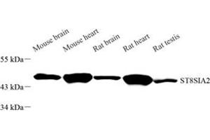 Western blot analysis of ST8SIA2 (ABIN7075720) at dilution of 1: 1000 (ST8SIA2 抗体)
